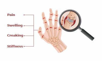 symptoms-og-knee-pain-due-to-muscle-weakness